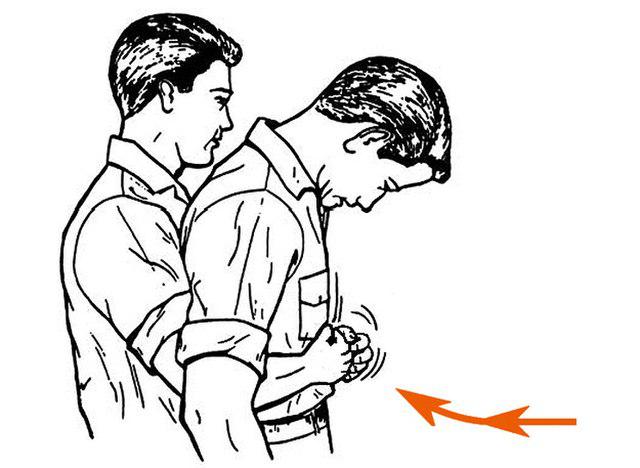 heimlich maneuver, david diaz, choking
