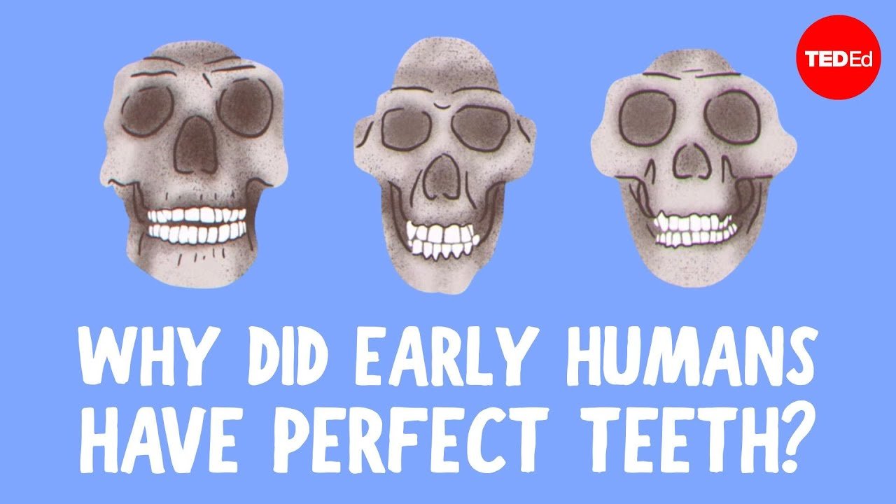 crooked teeth