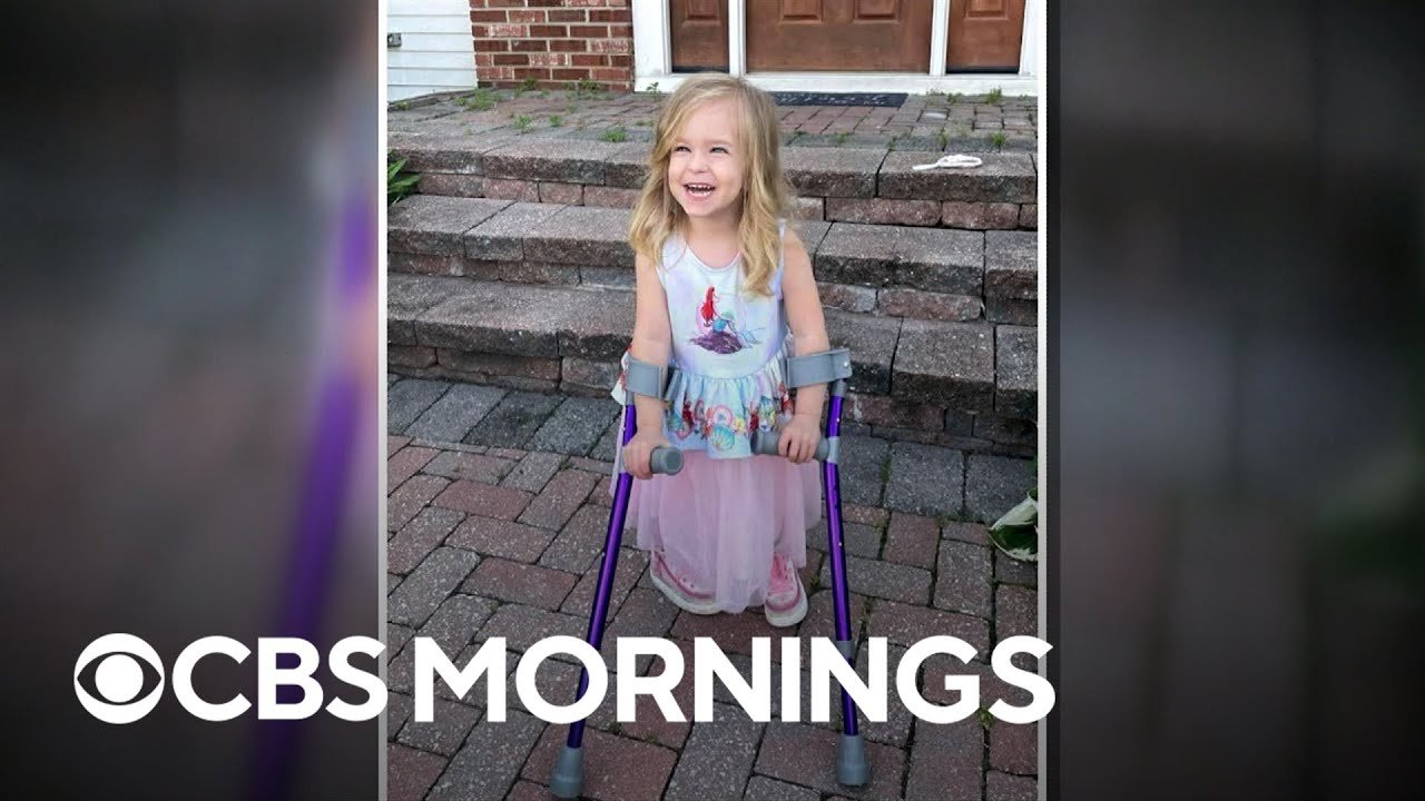 cerebral palsy; fitness coach; steph roach; unlikely friends