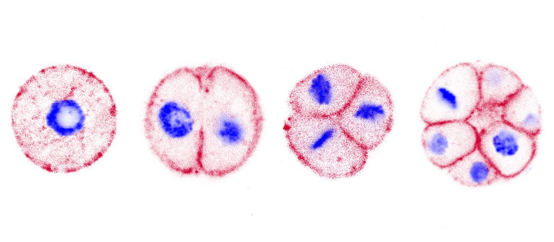 A sequence of images showing Chromosphaera perkinsii forming a colony.