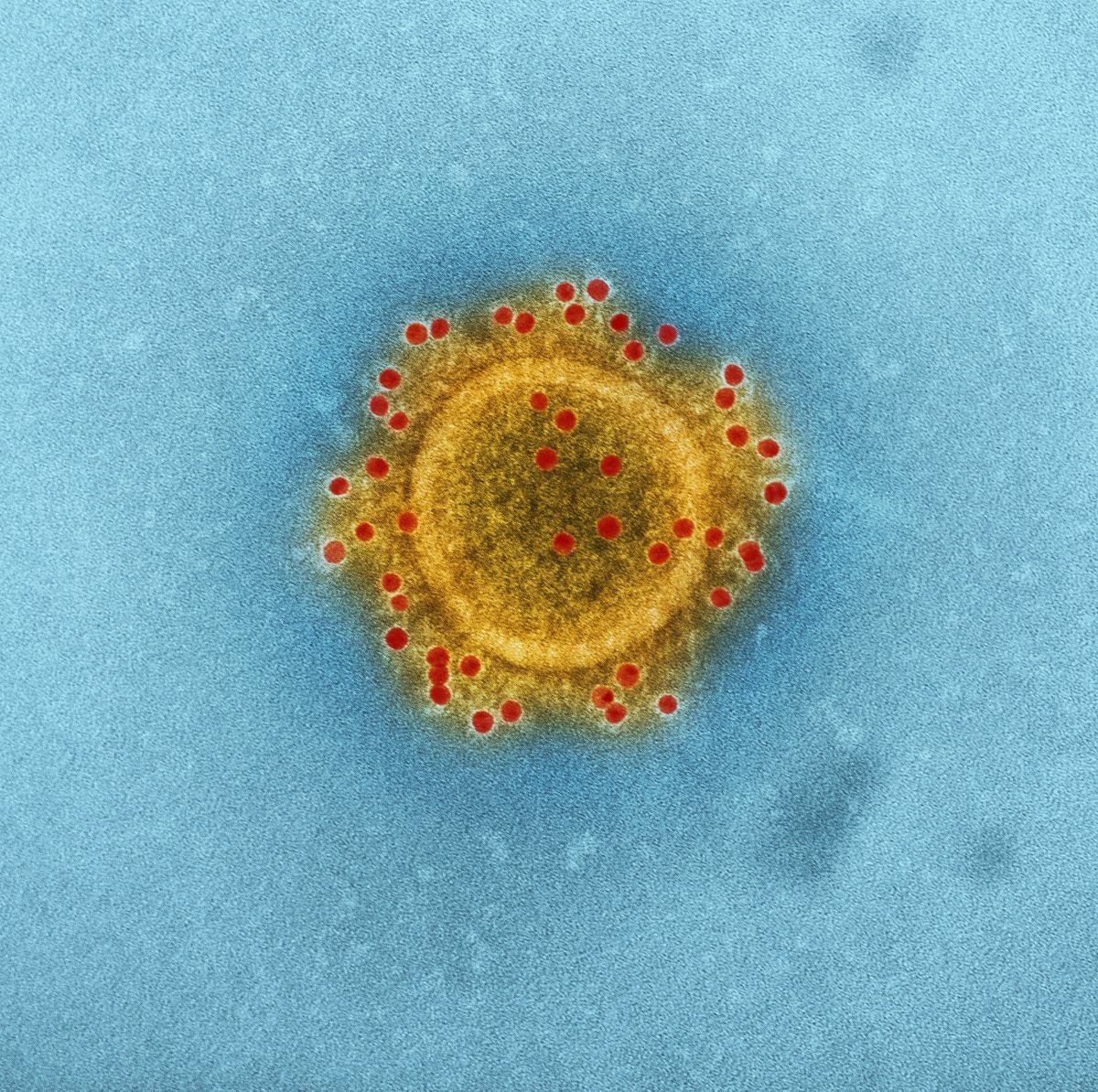 a yellow substance with red dots in it