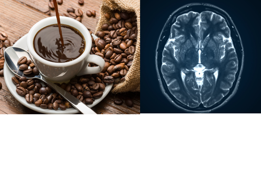 Cup of coffee surrounded by beans next to a brain scan
