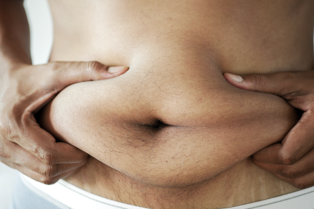 A close-up of a man holding up his belly fat.