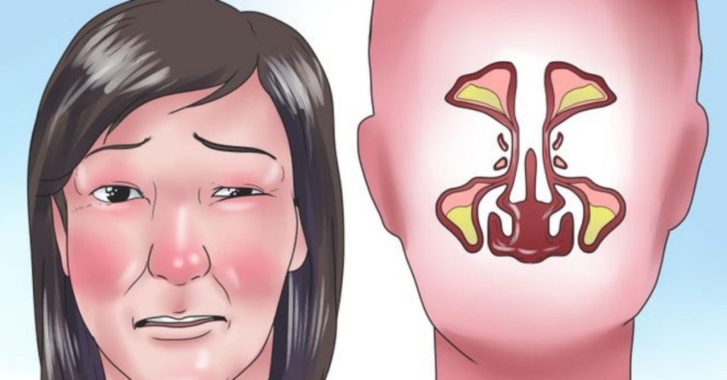 illustration of a woman with stuffy nose