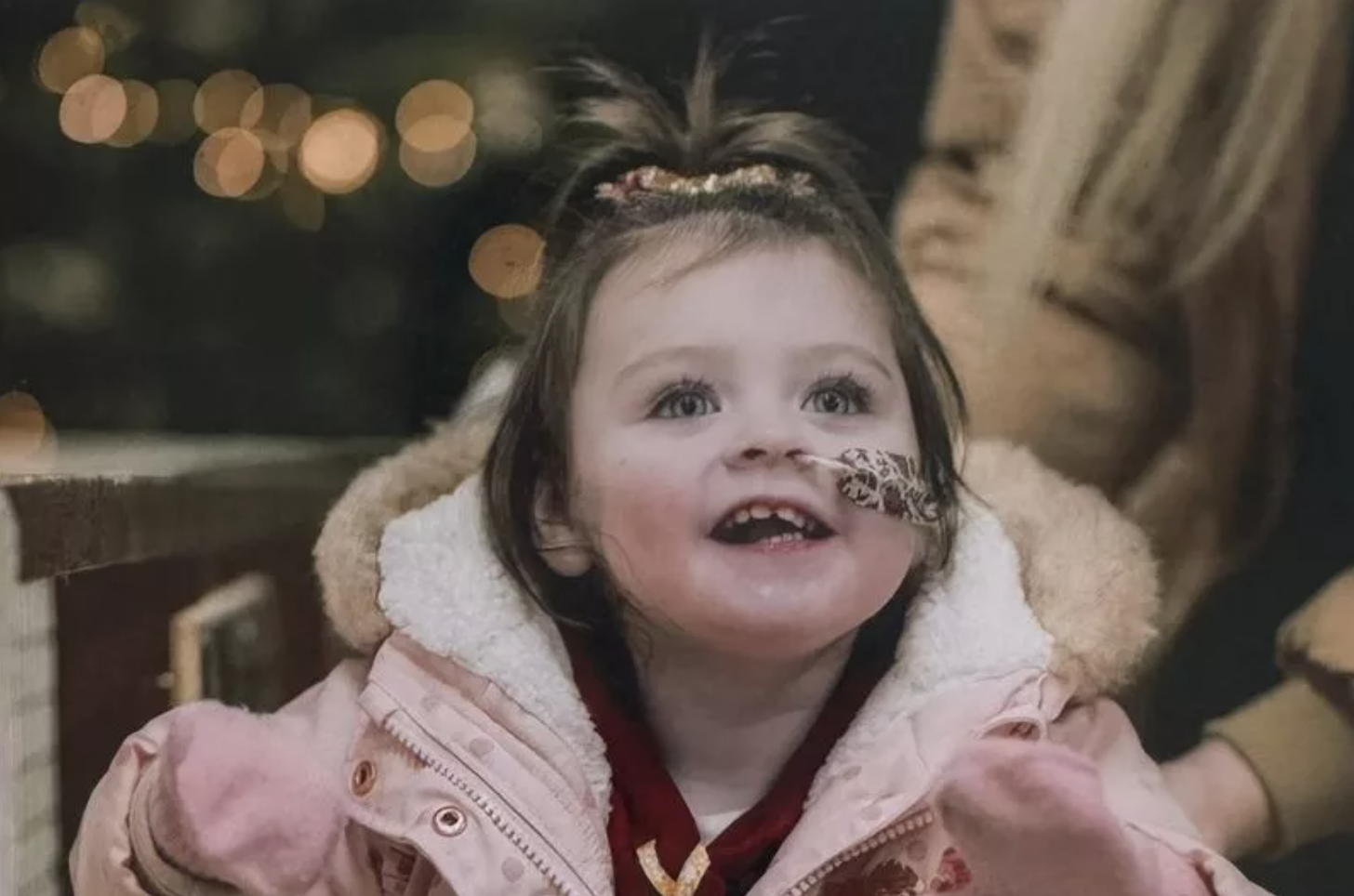 Little girl with a medical device up her nose, smiling outside on her parent's lap