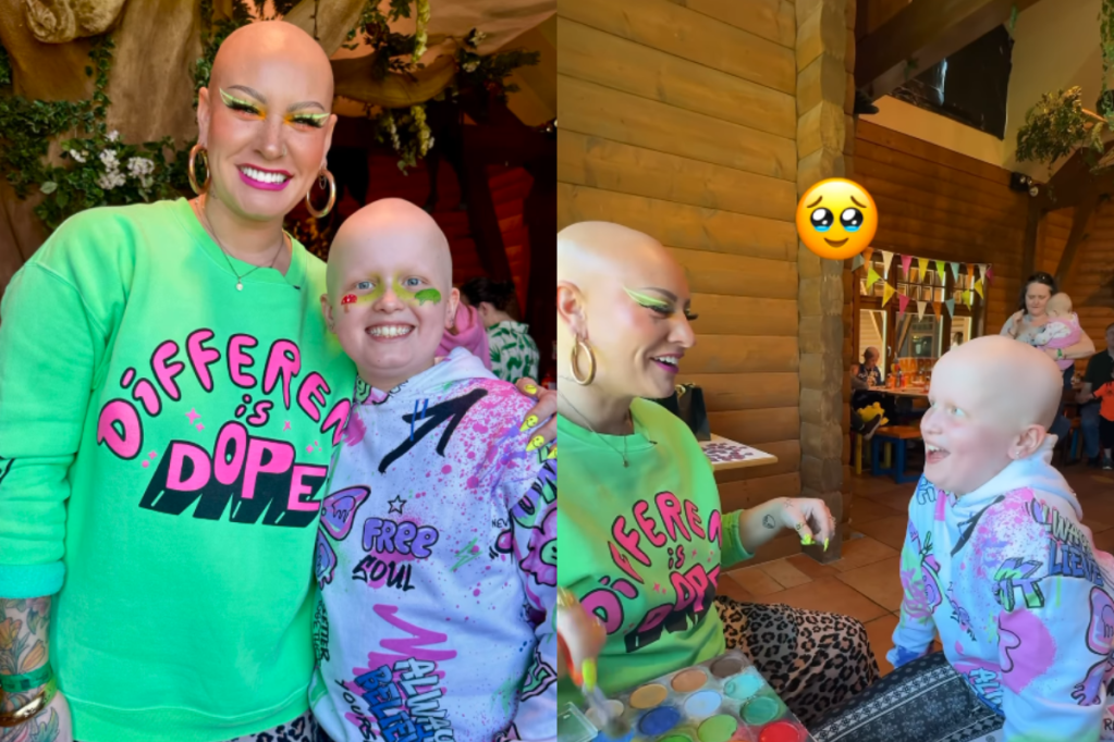 alopecia, alopecia girl, bald, makeup, makeup artist