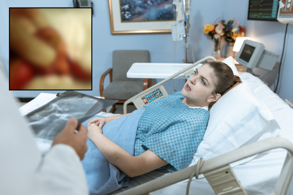 teratoma, tumor, cancer, women's health, women, health, hospital, doctor, OBGYN, reproductive health, ovarian cyst