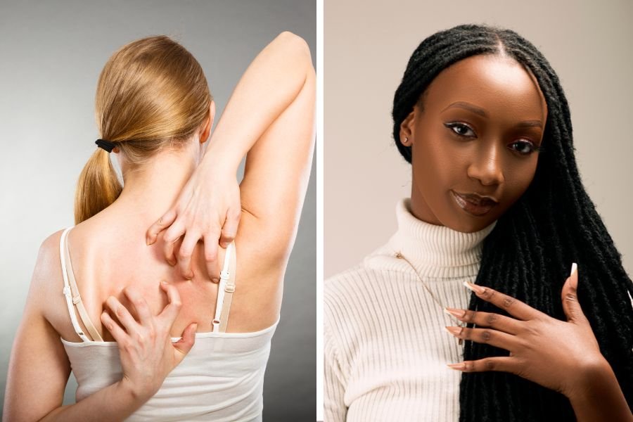 back scratching; touch starvation; touch depravation; the scratcher girls; back scratch business