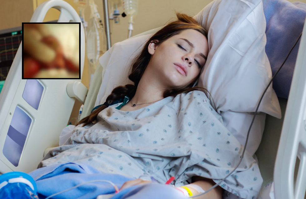 teratoma, ovarian cyst, women's health, viral TikTok, Savannah Stuthers, medical story, patient advocacy, tumor with teeth, health education, gynecology