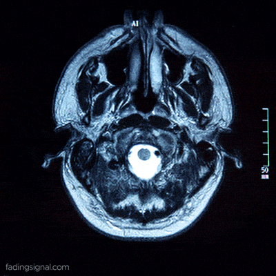 cat scan, ct scan, cat scan gif, ct scan gif, cat scan acronym