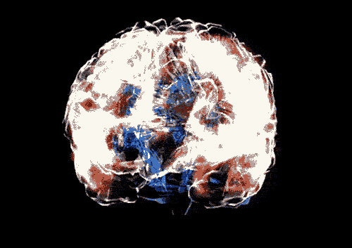 brain, mind neuroscience, mental health, amygdala, brain health