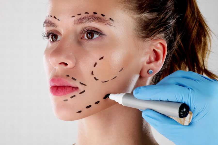 plastic surgery, cosmetic surgery, beauty standards, aging, wrinkles