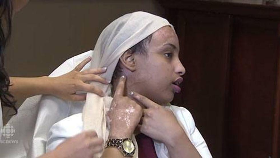 woman in a hijab revealing scars