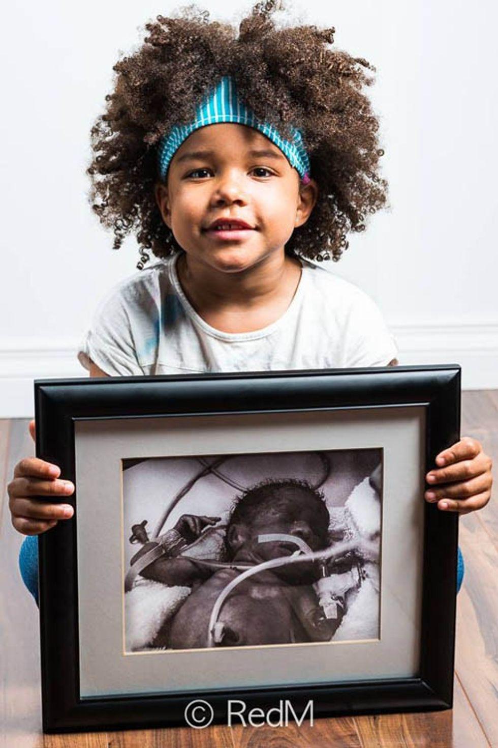 a little girl holds a black and white photograph of herself as a premature baby