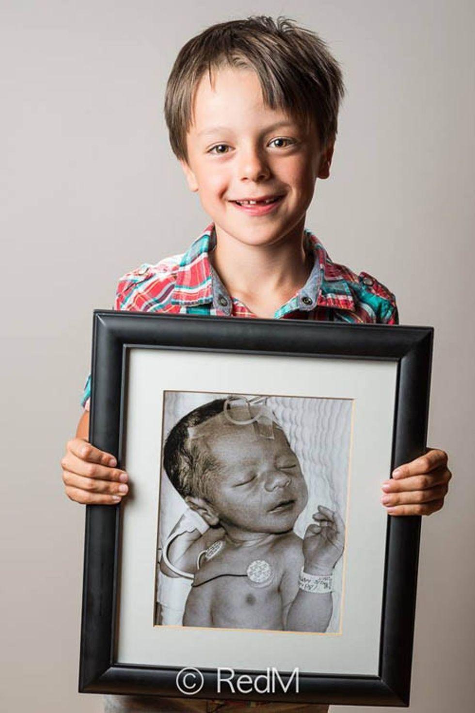 a young boy holds a black and white photograph of himself as a premature baby