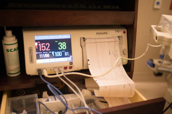 tocodynamometer, labor, selfies