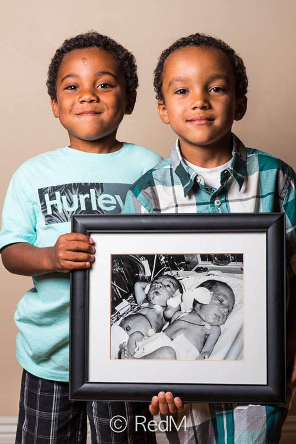 twin boys hold black and white photo of themselves as premature babies