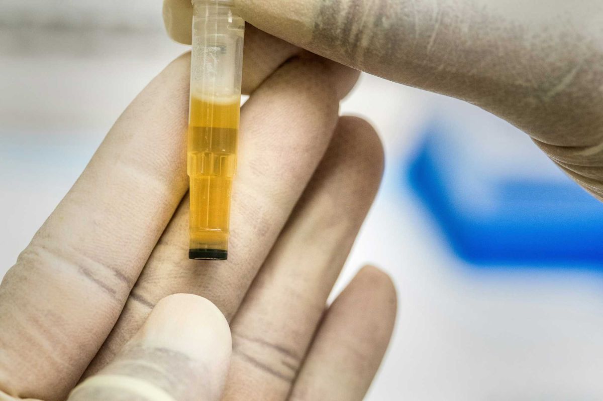 urine, urinalysis, pee, doctors, medicine, healthcare, wellness, reddit, reddit confessions, weird