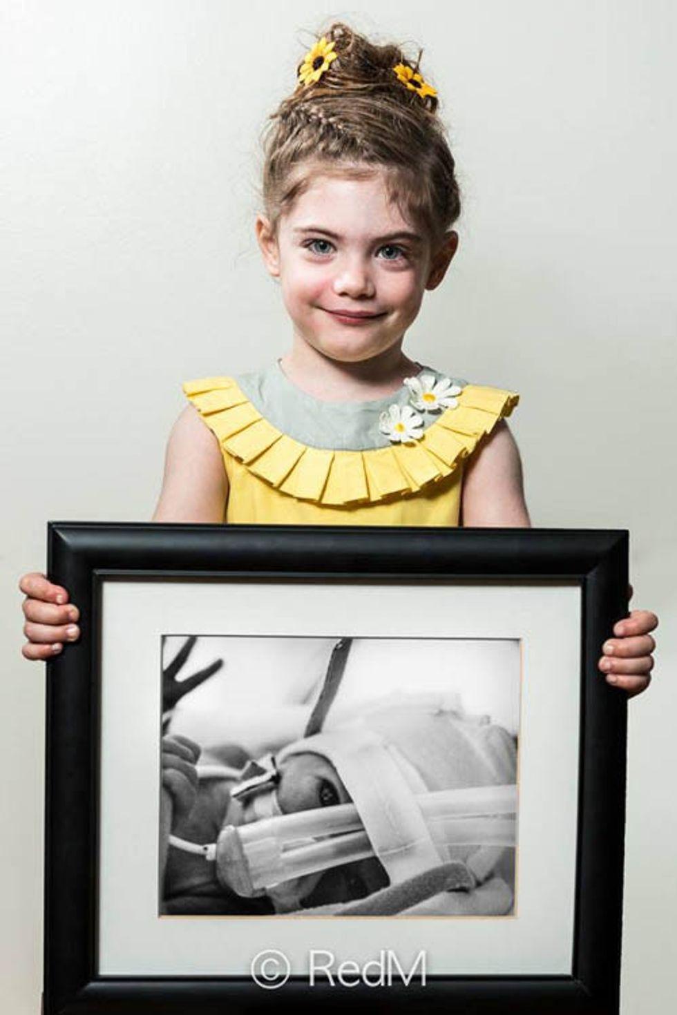 a little girl holds a black and white photograph of herself as a premature baby