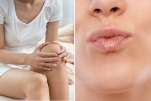 Someone holding their knee and someone puckering their lips for a kiss