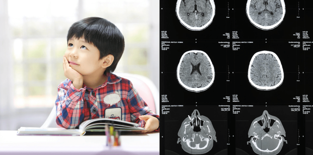 Surprising 16-year-long ADHD study proves researchers’ hypothesis totally wrong