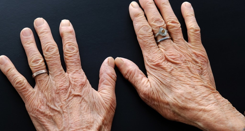 hands, getting older, aging