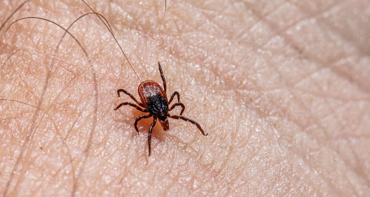 tick, tick removal, lyme disease