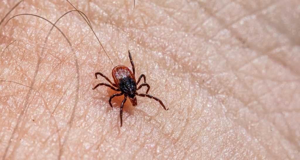 tick, tick removal, lyme disease