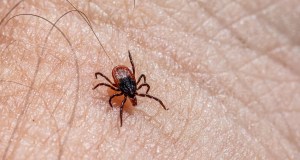 tick, tick removal, lyme disease