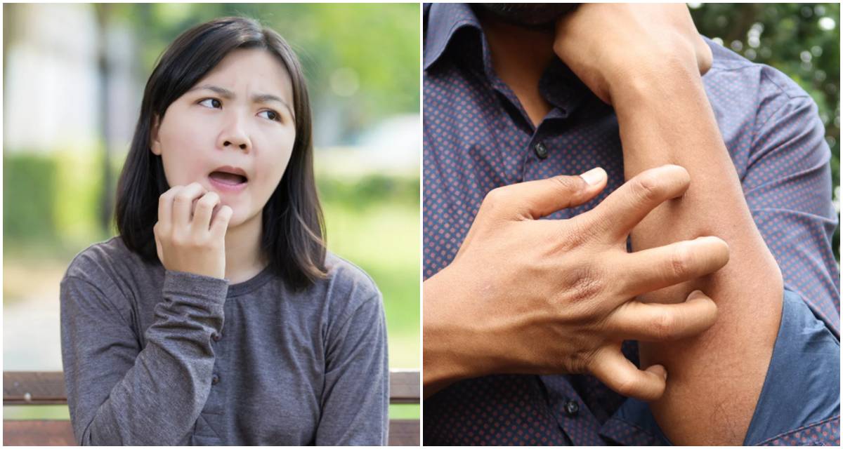 itch, scratch, science, skin irritation, upset woman