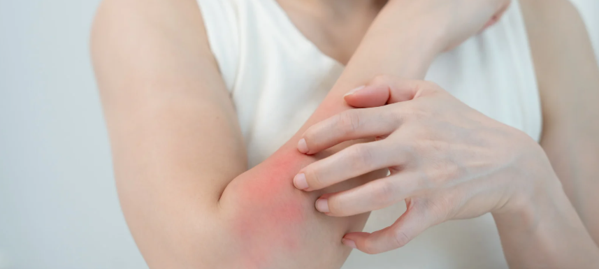 itch, scratch, skin irritation