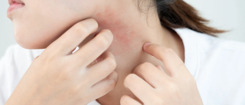 itch, scratch, skin irritation