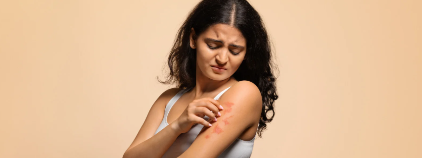itch, scratch, skin irritation