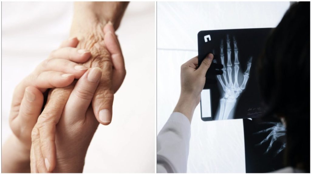 British woman holds her late daughter’s hand again after it was transplanted onto a quadruple amputee
