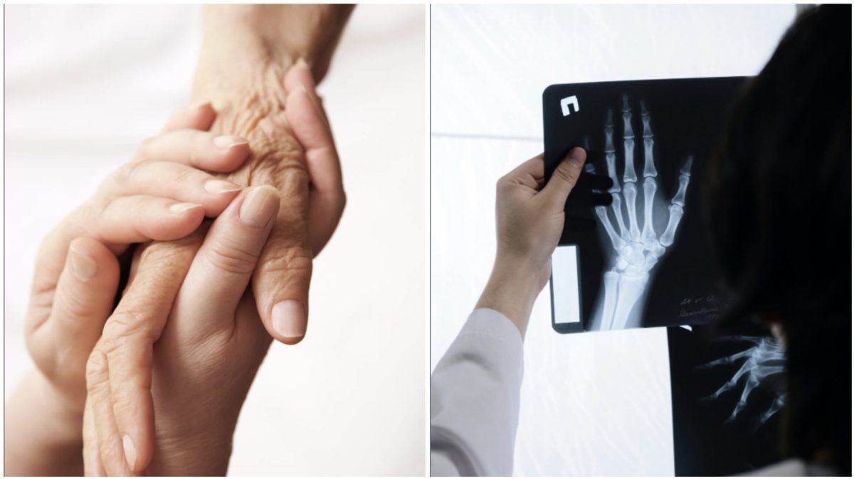 hand, transplant, organ donation, wholesome