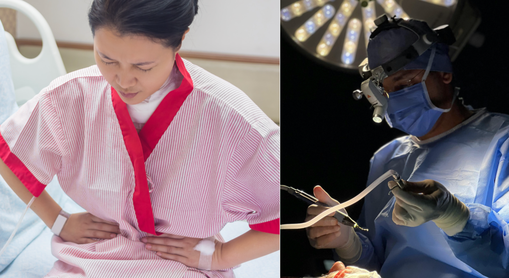 tummy tuck, medical negligence, surgical errors, patient safety, retained surgical items