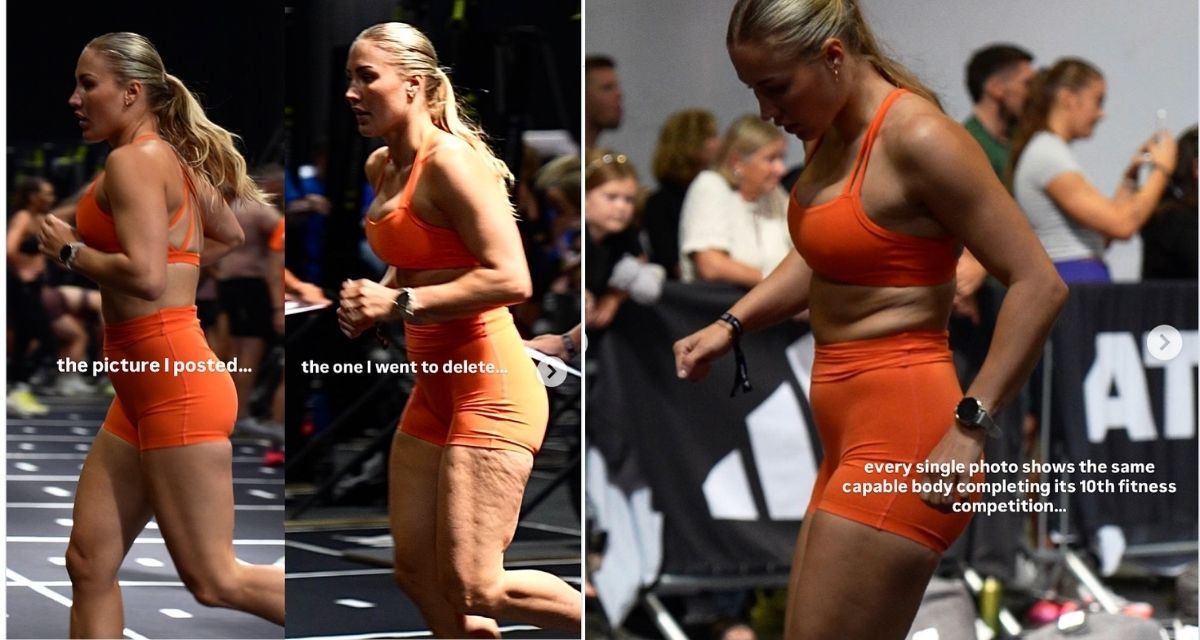 runner, cellulite, fitness