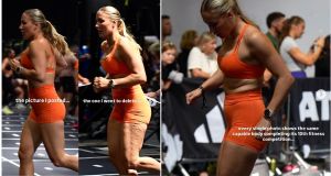 runner, cellulite, fitness