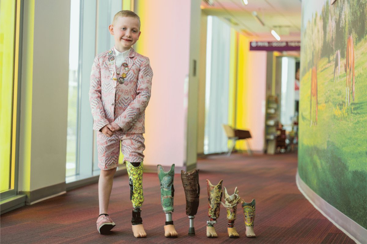 Arlo at Shriners Children's hospital with his "leggys".