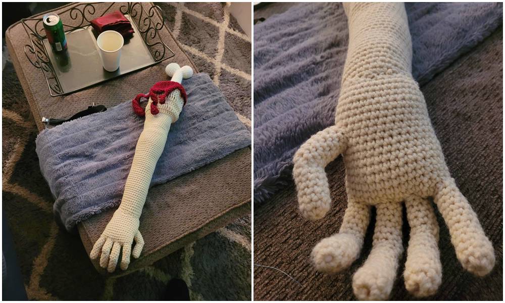 new arm, amputee, crochet