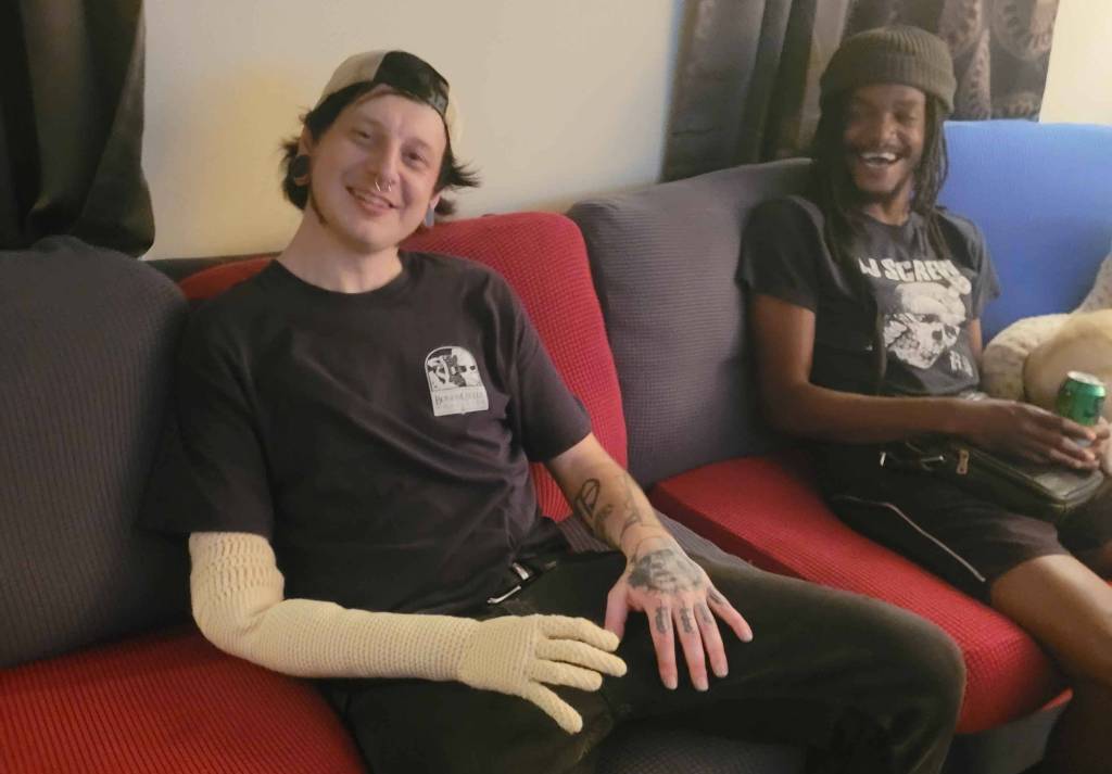 amputee, new arm, crochet