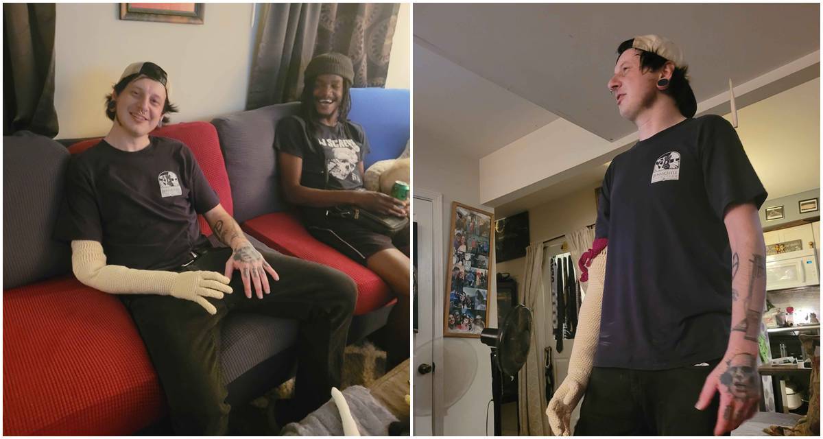 crocheted arm, amputee, morbid humor, cousins, joe tomasulo