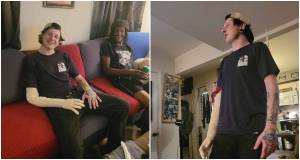 crocheted arm, amputee, morbid humor, cousins, joe tomasulo